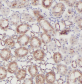 CTU2 Antibody
