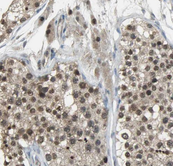 IZUMO4 Antibody