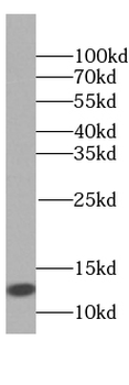 MICOS13 Rabbit Polyclonal Antibody