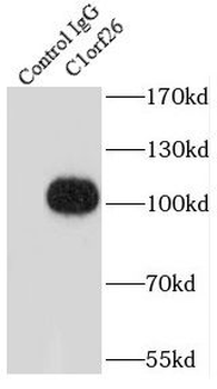 SWT1 Rabbit Polyclonal Antibody