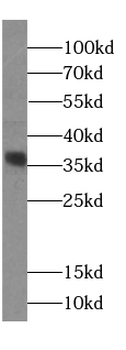 MENT Antibody