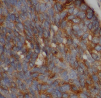 MENT Antibody