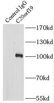 KIZ Antibody