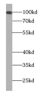 KIZ Antibody
