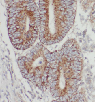 TMEM74B Rabbit Polyclonal Antibody