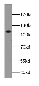 C3/C3b/C3c Mouse Monoclonal Antibody
