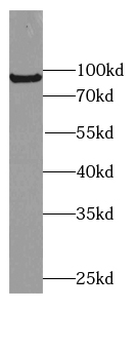 C4 Rabbit Polyclonal Antibody