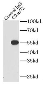 C9orf72 Antibody