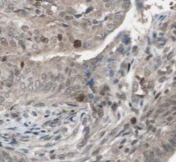 CAPS2 Antibody