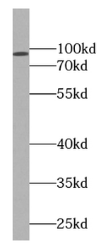 CLGN Rabbit Polyclonal Antibody