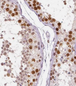 CLGN Rabbit Polyclonal Antibody