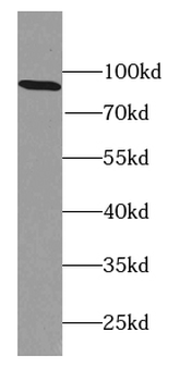 CAPN7 Rabbit Polyclonal Antibody