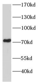 CAPN9 Rabbit Polyclonal Antibody