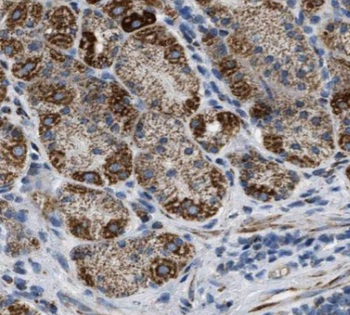 CAPN9 Rabbit Polyclonal Antibody