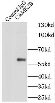 CAMK2B Antibody