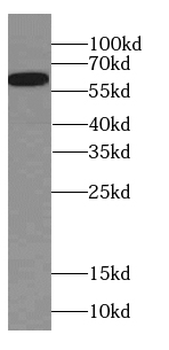 CAMK2B Antibody