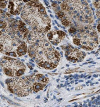CAMK2B Antibody