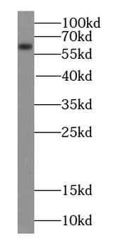 CAMK2B Antibody