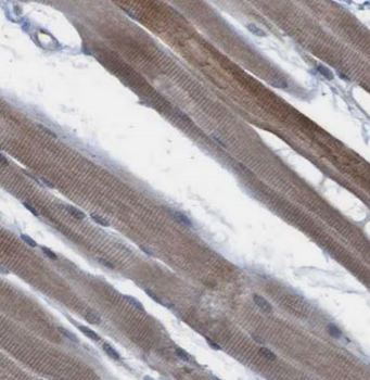 CAMK2B Antibody