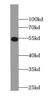 CAMK2D Antibody