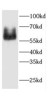 CAMK2G Antibody