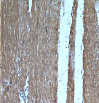 CAMK2G Antibody