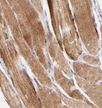 CAMK2G Antibody