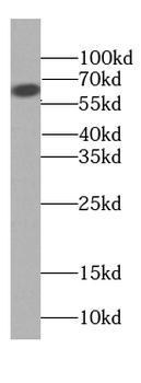 CPA6 Rabbit Polyclonal Antibody