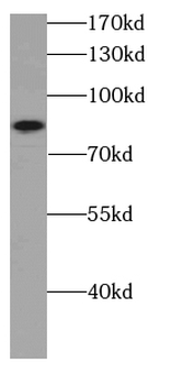 CARNS1 Antibody