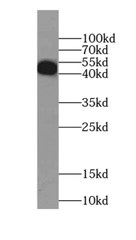 CSNK1E Rabbit Polyclonal Antibody