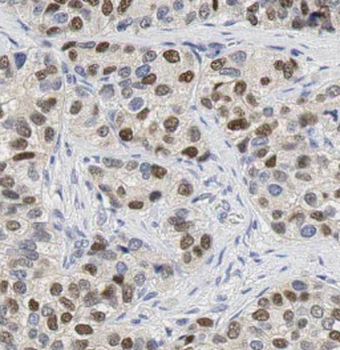 CSNK1E Rabbit Polyclonal Antibody