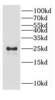 CSNK2B specific Rabbit Polyclonal Antibody