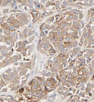 SLC7A1 Antibody