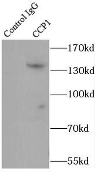 AGTPBP1 Antibody