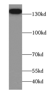 AGTPBP1 Antibody