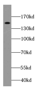 ITGAD Rabbit Polyclonal Antibody