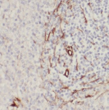 ITGA2B Rabbit Polyclonal Antibody