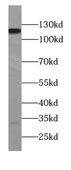 TSPYL2 Antibody
