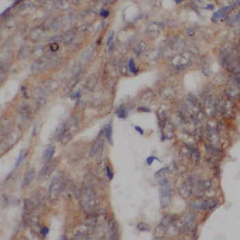 CEACAM3 Specific Rabbit Polyclonal Antibody