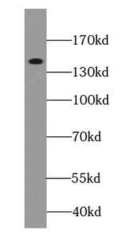 CP Mouse Monoclonal Antibody