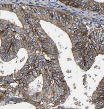 CP Mouse Monoclonal Antibody