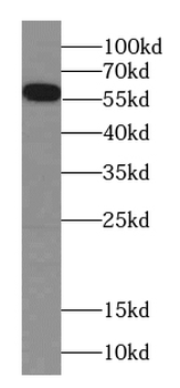 CES5A Antibody