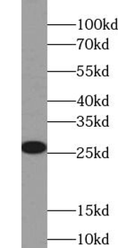 βHCG Antibody