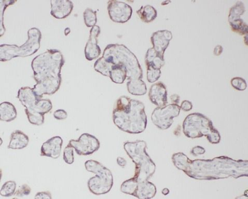 βHCG Antibody