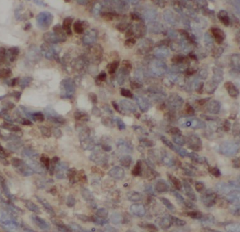 CGNL1 Antibody