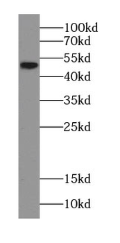 CHKA Antibody