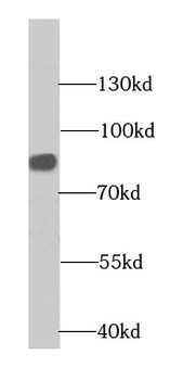 CHPF C-Terminal Antibody
