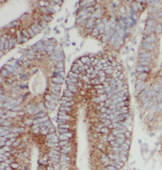 CHPF N-Terminal Antibody