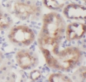 KIT Antibody