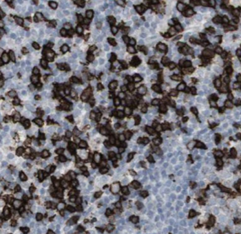 CLEC11A Antibody